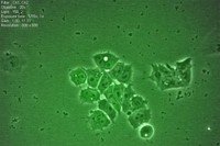 Cèl·lules mare de la recerca