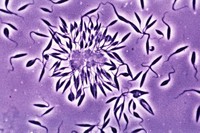 Microfotografia del Trypanosoma cruzi, el paràsit que causa la malaltia de Chagas (OMS/TDR)